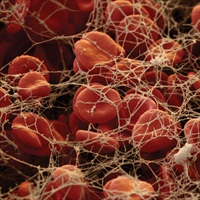 Test kit identifies genetic risk of thrombosis